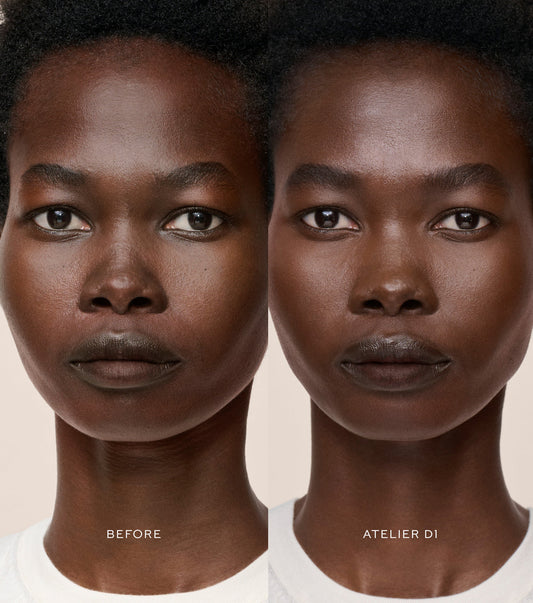 Vital Skincare Concealer (Corrector Líquido)