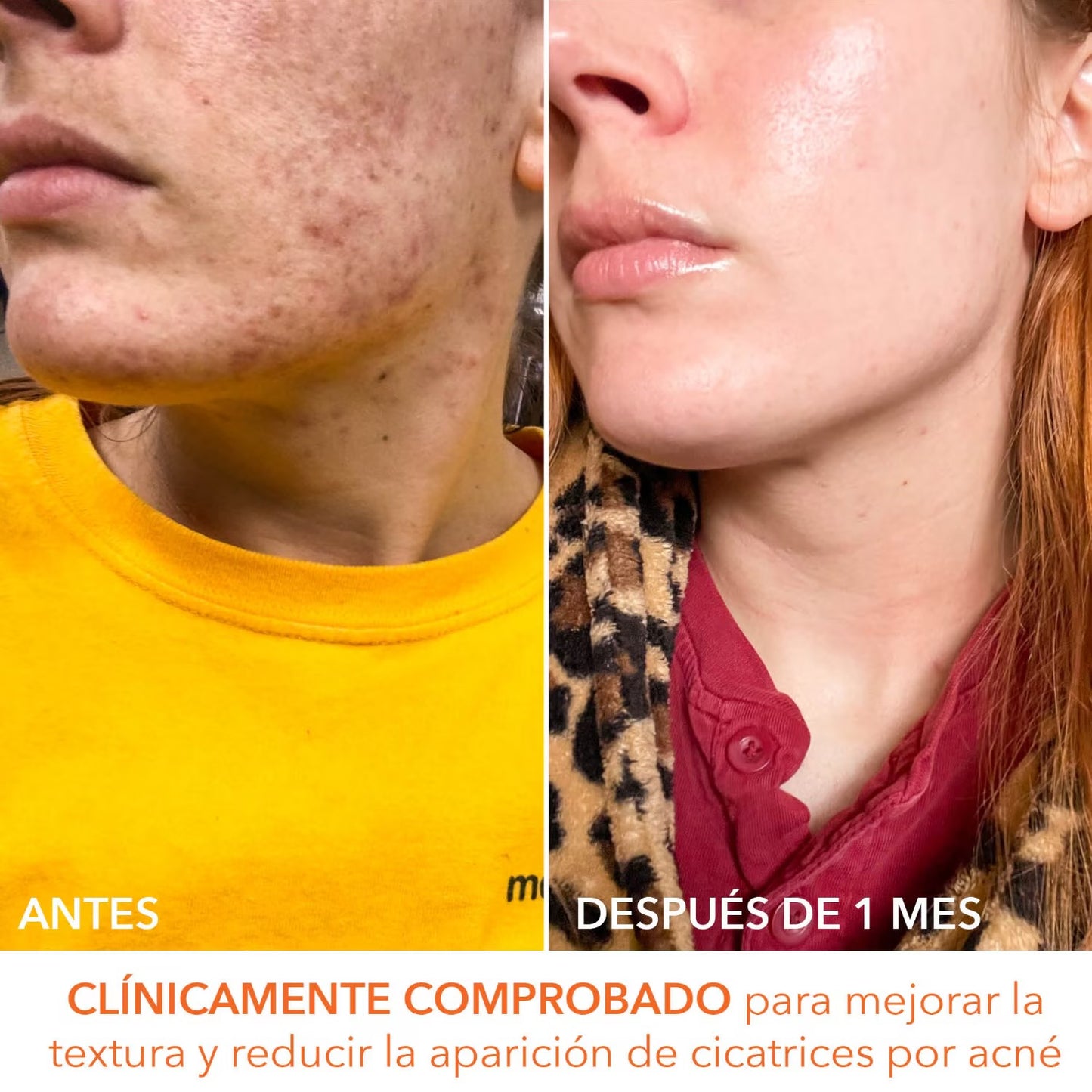 Alpha Beta Universal Daily Peel (Almohadillas Exfoliantes Diarias Universales)