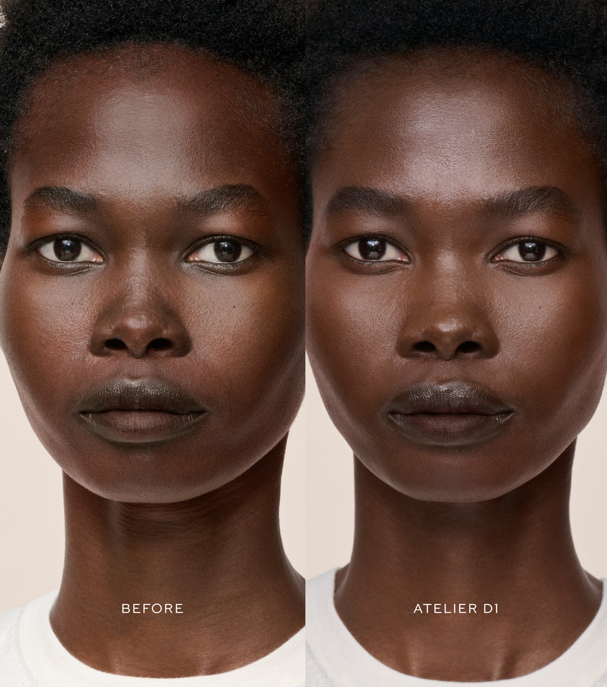 Vital Skincare Concealer (Corrector Líquido)