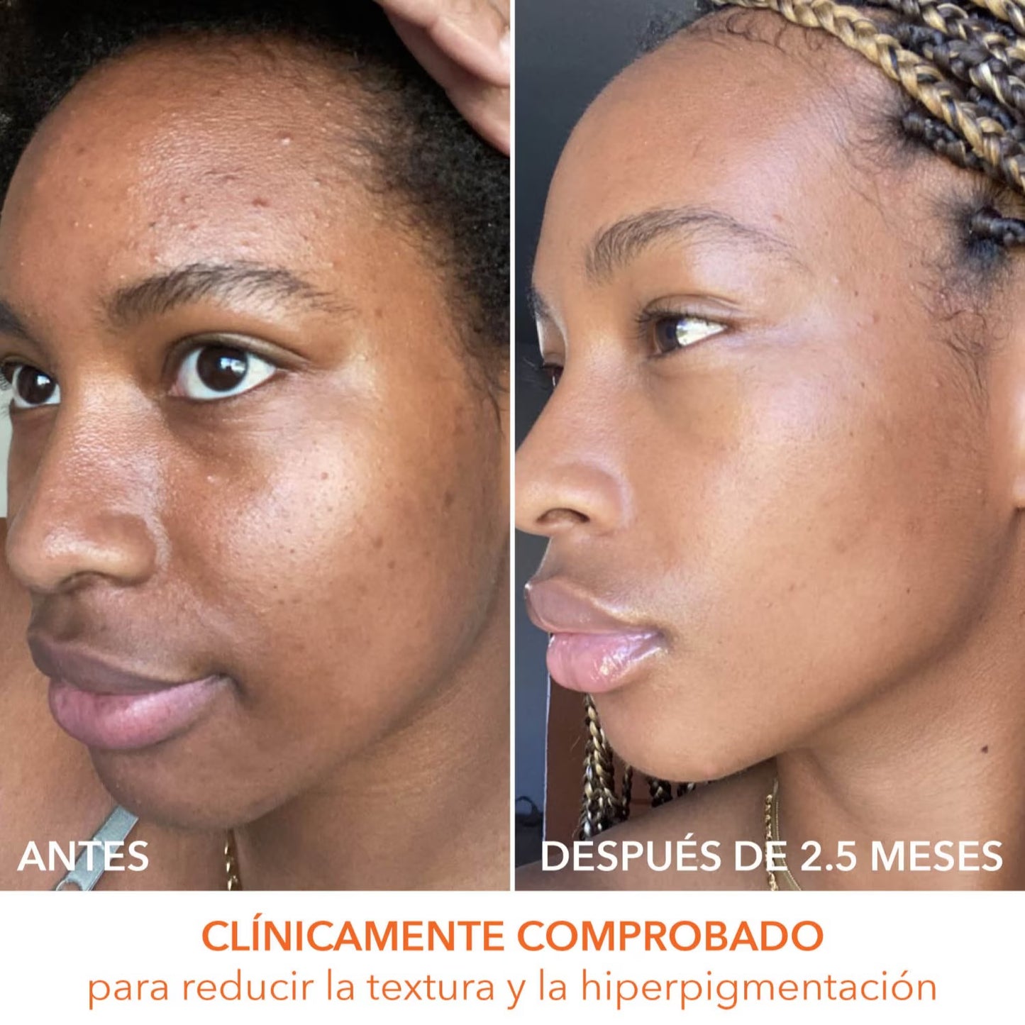 Alpha Beta Universal Daily Peel (Almohadillas Exfoliantes Diarias Universales)